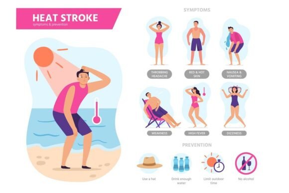 Heat Stroke Symptoms: Sunshock Explained